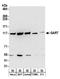 Phosphoribosylglycinamide Formyltransferase, Phosphoribosylglycinamide Synthetase, Phosphoribosylaminoimidazole Synthetase antibody, A304-311A, Bethyl Labs, Western Blot image 