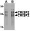 Cysteine Rich Secretory Protein 2 antibody, A10681, Boster Biological Technology, Western Blot image 
