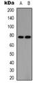 Protein Inhibitor Of Activated STAT 1 antibody, orb338887, Biorbyt, Western Blot image 