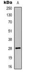 Major Histocompatibility Complex, Class II, DO Alpha antibody, abx133718, Abbexa, Western Blot image 