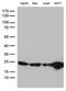 O-6-Methylguanine-DNA Methyltransferase antibody, LS-C794734, Lifespan Biosciences, Western Blot image 