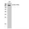 Protein Tyrosine Kinase 2 antibody, LS-C381246, Lifespan Biosciences, Western Blot image 