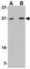 Transmembrane Protein 18 antibody, GTX31972, GeneTex, Western Blot image 