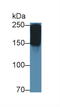 Alpha-2-macroglobulin antibody, LS-C292747, Lifespan Biosciences, Western Blot image 