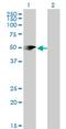 Phosphatidylinositol-5-Phosphate 4-Kinase Type 2 Alpha antibody, H00005305-M08, Novus Biologicals, Western Blot image 