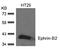 Ephrin B2 antibody, AP02708PU-N, Origene, Western Blot image 