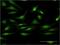 Protein Kinase C Delta antibody, H00005580-M09, Novus Biologicals, Immunocytochemistry image 