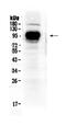 Interferon Gamma Receptor 1 antibody, PA5-79443, Invitrogen Antibodies, Western Blot image 