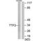 Forkhead Box E1 antibody, PA5-49759, Invitrogen Antibodies, Western Blot image 