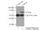 Coronin 1C antibody, 14749-1-AP, Proteintech Group, Immunoprecipitation image 