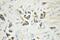 Caspase 6 antibody, 10198-1-AP, Proteintech Group, Immunohistochemistry paraffin image 