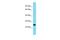 Chromosome 2 Open Reading Frame 49 antibody, A14625, Boster Biological Technology, Western Blot image 