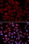 ACK1 antibody, orb136695, Biorbyt, Immunofluorescence image 
