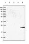 Gamma-Glutamyltransferase 1 antibody, NBP2-54724, Novus Biologicals, Western Blot image 