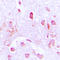 Cell Division Cycle 37 antibody, LS-C353312, Lifespan Biosciences, Immunohistochemistry frozen image 