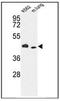 Inositol-Trisphosphate 3-Kinase A antibody, AP15175PU-N, Origene, Western Blot image 