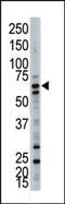 Ubiquilin 3 antibody, 61-132, ProSci, Western Blot image 