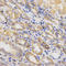 Integrin Subunit Beta 5 antibody, STJ24261, St John