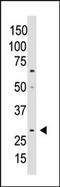 Cellular Communication Network Factor 5 antibody, AP13230PU-N, Origene, Western Blot image 