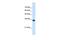 Solute Carrier Family 25 Member 38 antibody, GTX46811, GeneTex, Western Blot image 