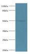 Aldehyde Dehydrogenase 3 Family Member A1 antibody, LS-C369215, Lifespan Biosciences, Western Blot image 