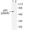 p53 antibody, AP01660PU-N, Origene, Western Blot image 