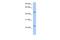 Transmembrane And Coiled-Coil Domains 1 antibody, A05996, Boster Biological Technology, Western Blot image 