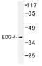 Lysophosphatidic Acid Receptor 2 antibody, AP01310PU-N, Origene, Western Blot image 