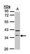 Ras association domain-containing protein 2 antibody, PA5-21832, Invitrogen Antibodies, Western Blot image 