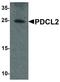 Phosducin Like 2 antibody, LS-C336185, Lifespan Biosciences, Western Blot image 