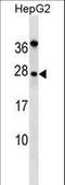 Noggin antibody, LS-C158405, Lifespan Biosciences, Western Blot image 