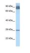 Lecithin Retinol Acyltransferase antibody, NBP1-79775, Novus Biologicals, Western Blot image 