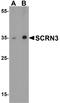 Secernin 3 antibody, A17217, Boster Biological Technology, Western Blot image 