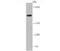 Complement C4A (Rodgers Blood Group) antibody, NBP2-66995, Novus Biologicals, Western Blot image 