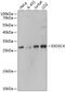 Exosome complex exonuclease RRP41 antibody, A08953, Boster Biological Technology, Western Blot image 