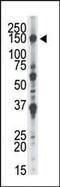 Formin Like 2 antibody, PA5-15336, Invitrogen Antibodies, Western Blot image 