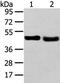 Tribbles Pseudokinase 2 antibody, PA5-51306, Invitrogen Antibodies, Western Blot image 