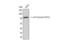 Tumor Protein P73 antibody, STJ90152, St John