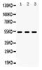 5-Hydroxytryptamine Receptor 2A antibody, PB9599, Boster Biological Technology, Western Blot image 