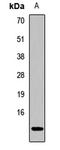 CDC28 Protein Kinase Regulatory Subunit 2 antibody, LS-C667753, Lifespan Biosciences, Western Blot image 