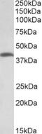 Threonine Synthase Like 2 antibody, NBP2-26173, Novus Biologicals, Western Blot image 