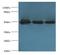 Keratin 38 antibody, LS-C369885, Lifespan Biosciences, Western Blot image 