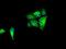 Isocitrate Dehydrogenase (NAD(+)) 3 Alpha antibody, MA5-25006, Invitrogen Antibodies, Immunocytochemistry image 