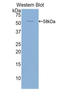 Activated Leukocyte Cell Adhesion Molecule antibody, LS-C292611, Lifespan Biosciences, Western Blot image 