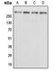 Kalirin RhoGEF Kinase antibody, MBS821543, MyBioSource, Western Blot image 