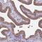 Nephrocystin 1 antibody, HPA046093, Atlas Antibodies, Immunohistochemistry paraffin image 