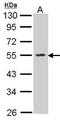 Sphingosine Kinase 1 antibody, GTX104724, GeneTex, Western Blot image 