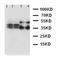 Resistin antibody, orb27655, Biorbyt, Western Blot image 