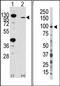Fibroblast Growth Factor Receptor 2 antibody, AP14338PU-N, Origene, Western Blot image 