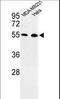 Egl-9 Family Hypoxia Inducible Factor 2 antibody, LS-C167661, Lifespan Biosciences, Western Blot image 